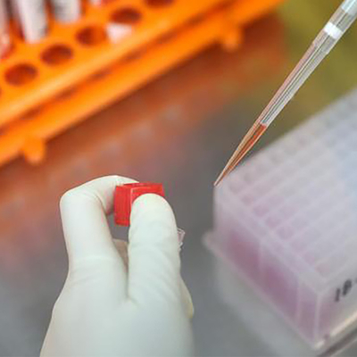 সংক্রামক রোগ পরীক্ষার কিট IgG IgM Monkeypox ISO সার্টিফিকেট 15 মিনিটের মধ্যে দ্রুত